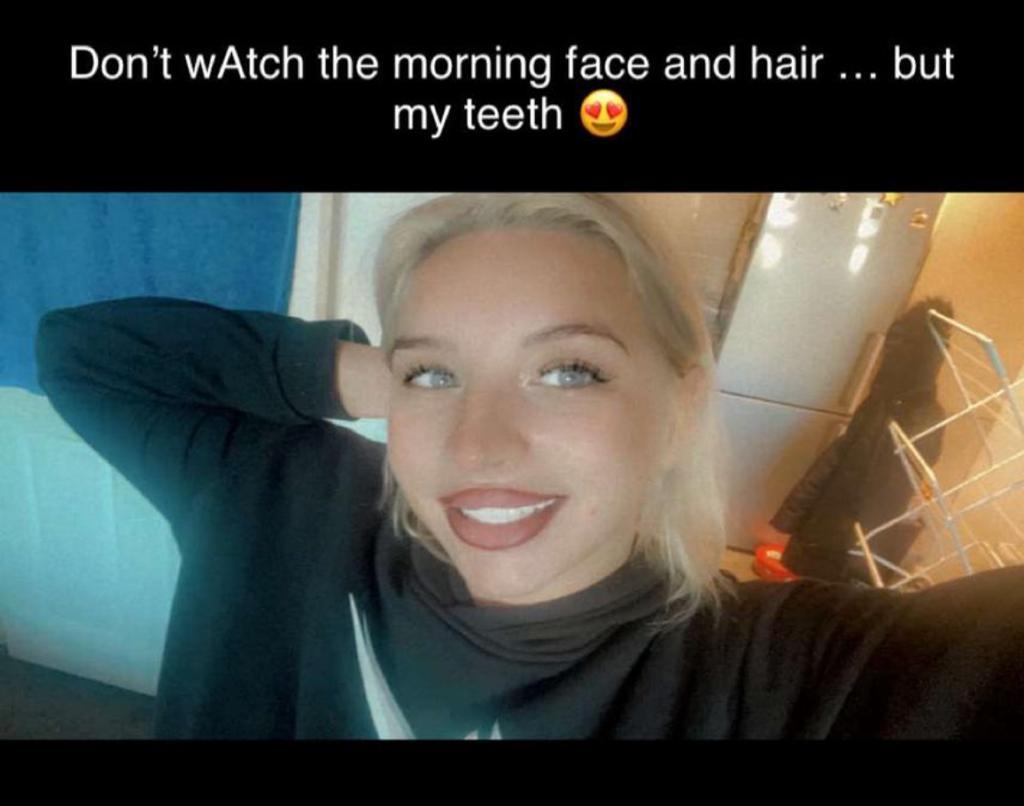 Hannah — Hollywood smile dental treatment in Turkey
