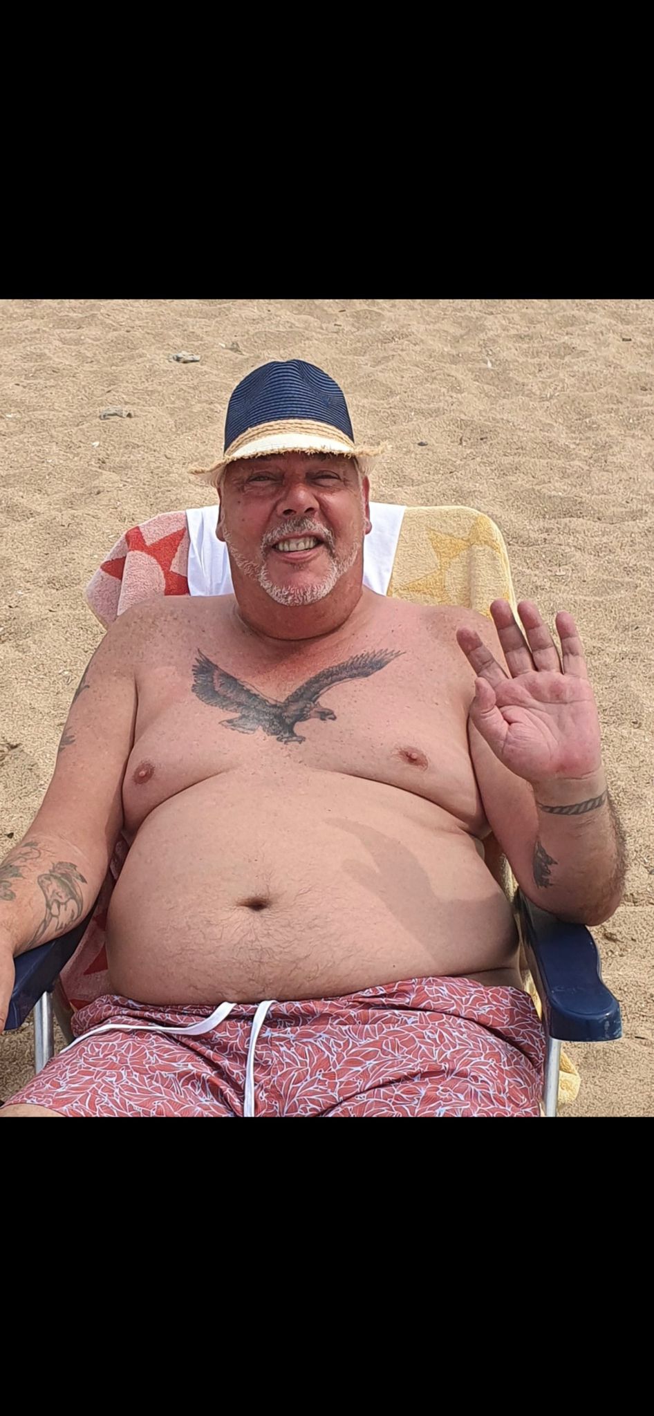 Mark Render — before weight loss surgery